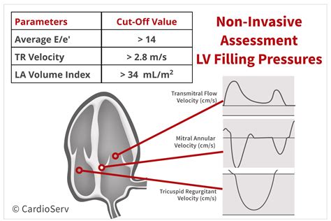 normal lv filling pressure.